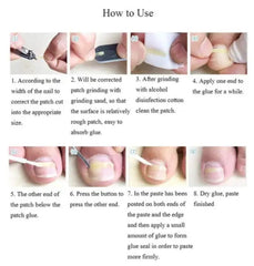 Parche corrector de ortodoncia para uñas encarnadas, inflamaciones y cortaúñas para manicura.